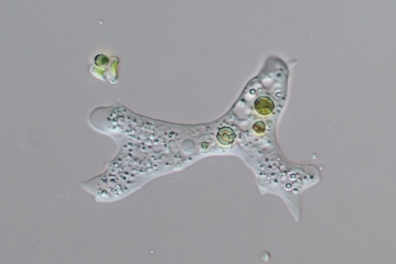 Observation de protozoaires - les amibes - 2mn 30s